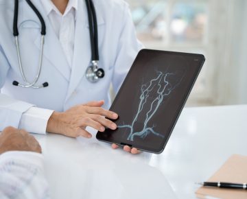 Inteligência Artificial agiliza diagnóstico de AVC