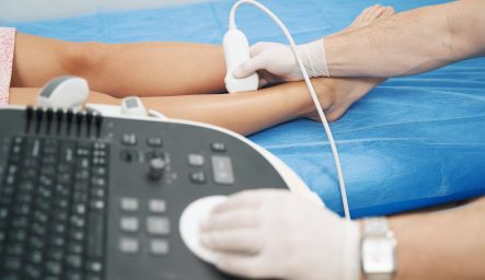 AVC e trombose: entenda as diferenças, semelhanças e como prevenir