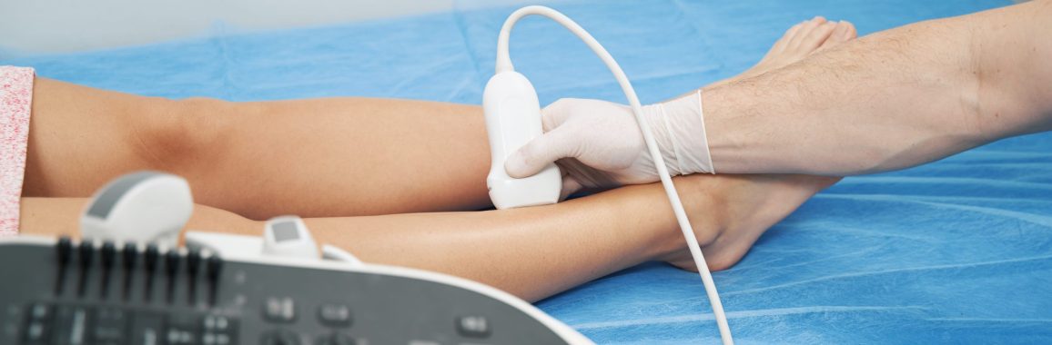 AVC e trombose: entenda as diferenças, semelhanças e como prevenir