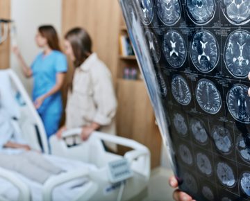 Especialistas explicam diferenças entre AVC isquêmico e hemorrágico